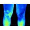 fluke_ti400_humanthermografie_beine_598695956